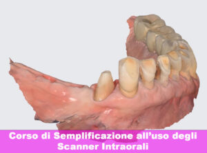 Corso all'uso degli scanner intraorali